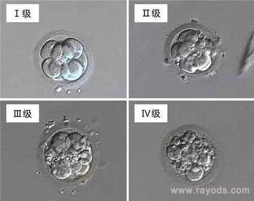 衡阳做供卵在哪家医院可做_衡阳供卵试管机构怎么选_试管婴儿的胚胎等级怎么