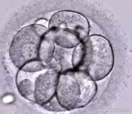 攀枝花有代孕成功的么_攀枝花代孕靠谱中介_三分钟教你如何识别试管婴儿胚胎