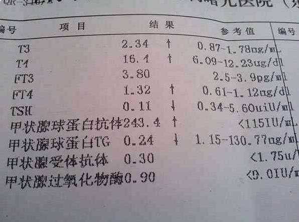 北京试管代孕排名 北京有精子库的试管医院 ‘胎囊数据看男女准吗’