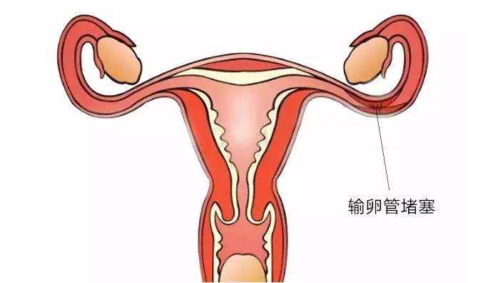 杭州代怀哪家安全 杭州试管婴儿的流程步骤试管婴儿的详细流程步骤 ‘怎么根
